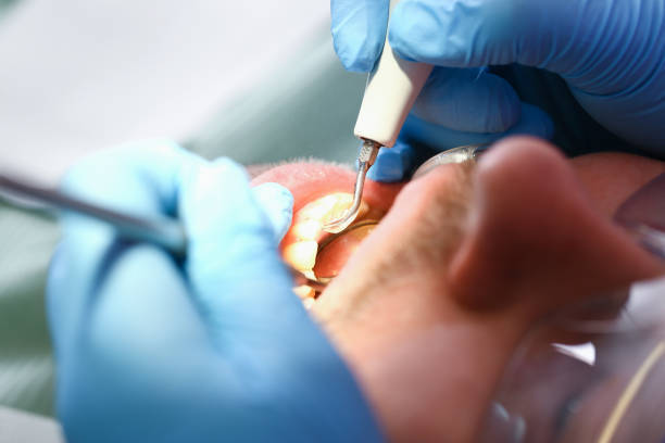 Best Pediatric Emergency Dentist in Hiller, PA