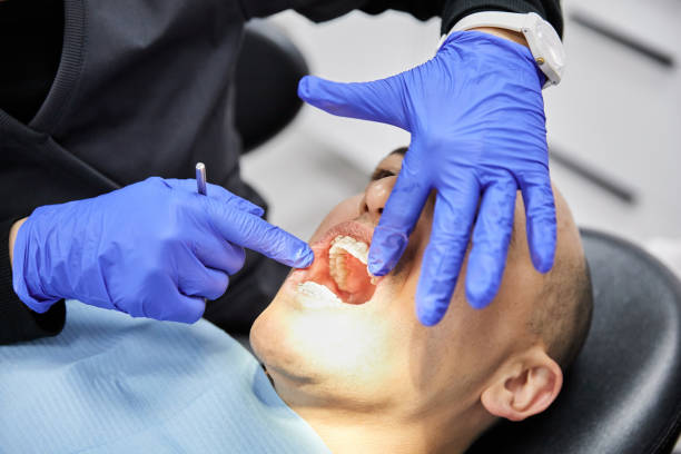 Best Emergency Dental Care for Broken or Chipped Teeth in Hiller, PA